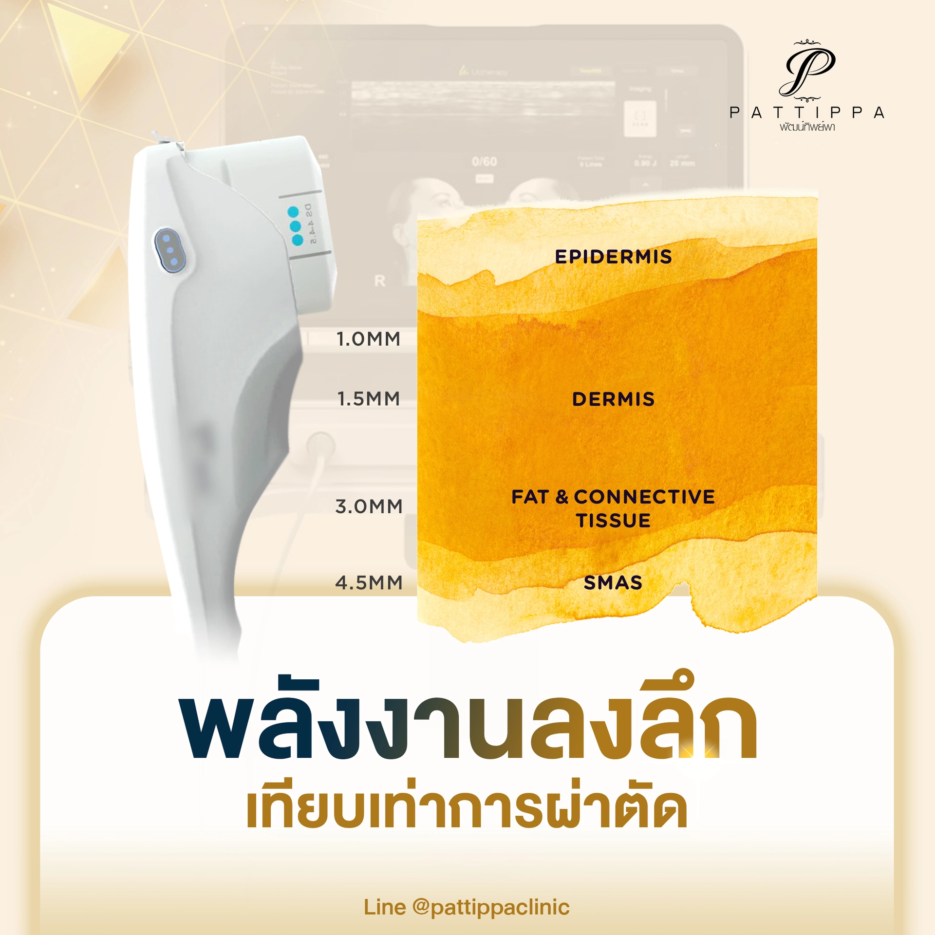 patt_web_ulthera_001.webp